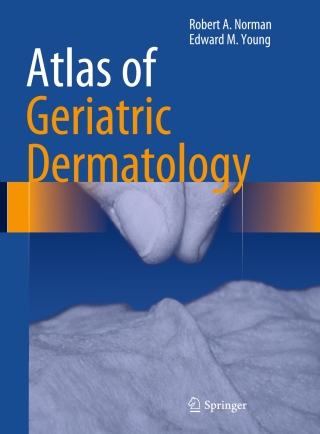 表紙画像: Atlas of Geriatric Dermatology 9781447145783