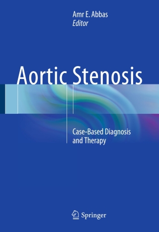 Imagen de portada: Aortic Stenosis 9781447152415