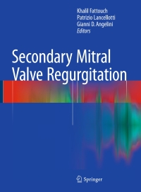 Cover image: Secondary Mitral Valve Regurgitation 9781447164876