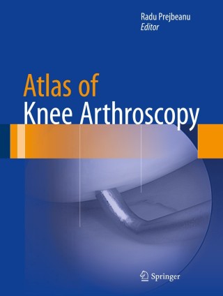Cover image: Atlas of Knee Arthroscopy 9781447165927