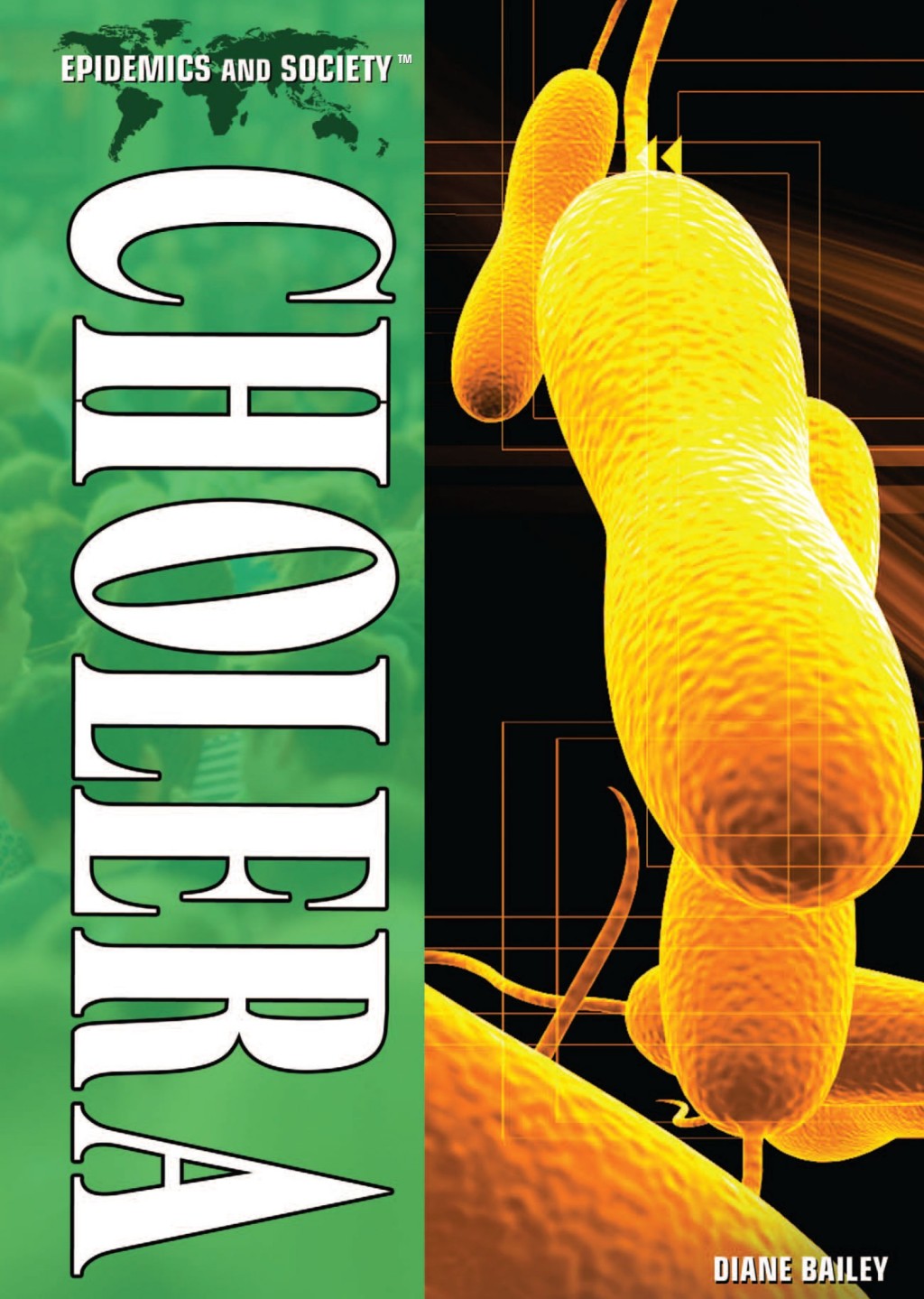 Cholera
