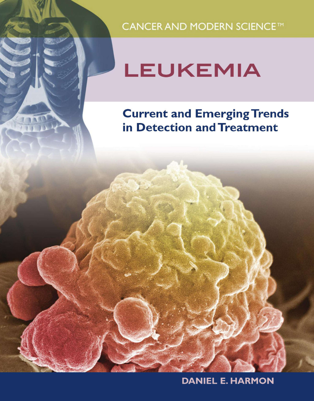 Leukemia Current and Emerging Trends in Detection and Treatment