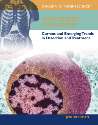 Cover image: Thyroid Cancer 9781448813087