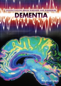 Cover image: Dementia 9781448855452