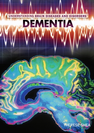 صورة الغلاف: Dementia 9781448855452