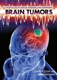 Imagen de portada: Brain Tumors 9781448855445