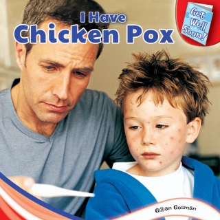 صورة الغلاف: I Have Chicken Pox 9781448874118