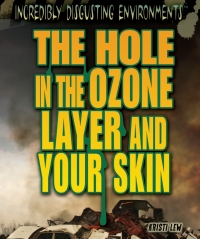 صورة الغلاف: The Hole in the Ozone Layer and Your Skin 9781448884117