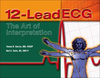 Titelbild: 12-Lead ECG: The Art of Interpretation 1st edition 9780763712846
