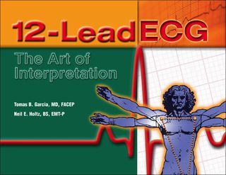 Cover image: 12-Lead ECG 1st edition 9780763712846