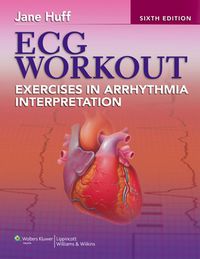 Cover image: ECG Workout: Exercises in Arrhythmia Interpretation 6th edition 9781451115536