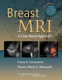 Cover image: Breast MRI
