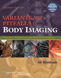 Cover image: Variants and Pitfalls in Body Imaging 2nd edition