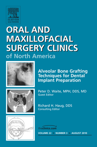Imagen de portada: Alveolar Bone Grafting Techniques in Dental Implant Preparation, An Issue of Oral and Maxillofacial Surgery Clinics 9781437724721