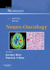 Imagen de portada: Neuro-Oncology 9780750675161