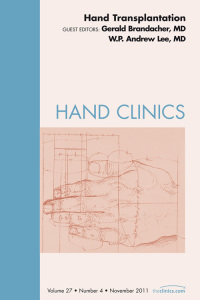 Cover image: Hand Transplantation, An Issue of Hand Clinics 9781455779833