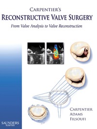 صورة الغلاف: Carpentier's Reconstructive Valve Surgery 9780721691688