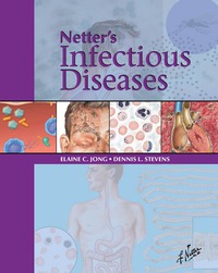 Imagen de portada: Netter's Infectious Diseases 9781437701265