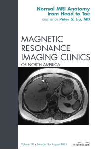 Imagen de portada: Normal MR Anatomy, An Issue of Magnetic Resonance Imaging Clinics 9781455710355