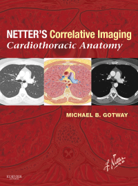 Titelbild: Netter’s Correlative Imaging: Cardiothoracic Anatomy 9781437704402