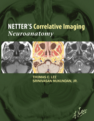 Cover image: Netter’s Correlative Imaging: Neuroanatomy 9781437704150