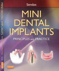 Cover image: Mini Dental Implants 9781455743865