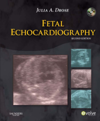 Titelbild: Fetal Echocardiography 2nd edition 9781416056690