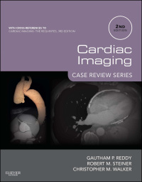 Titelbild: Cardiac Imaging: Case Review Series 2nd edition 9780323065191