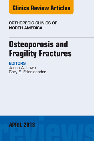 Imagen de portada: Osteoporosis and Fragility Fractures, An Issue of Orthopedic Clinics 9781455771318