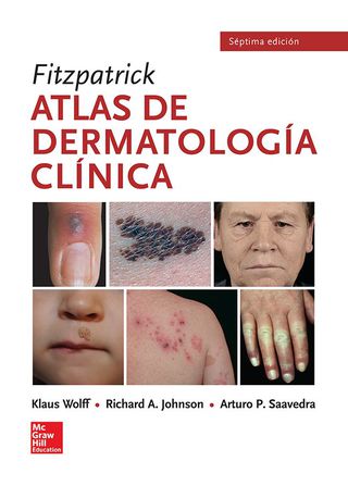 Imagen de portada: Fitzpatrick. Atlas de dermatología clínica 7th edition 9786071512048