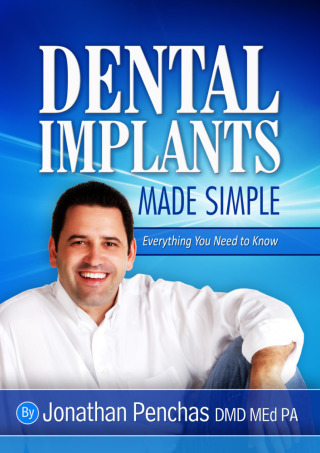 表紙画像: Dental Implants Made Simple