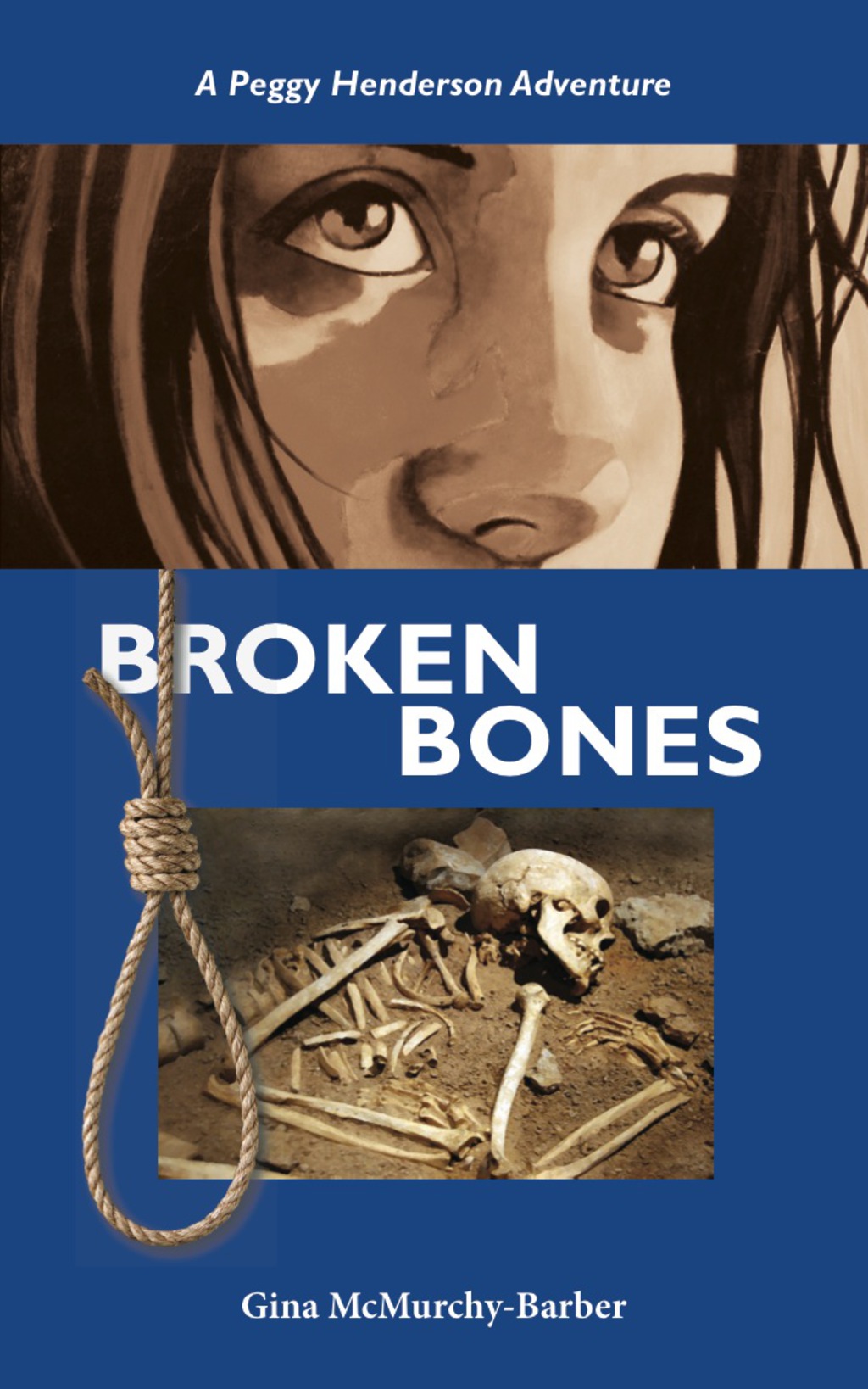 Broken Bones (eBook)