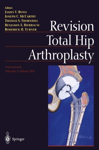 Cover image: Revision Total Hip Arthroplasty 1st edition 9781461271314