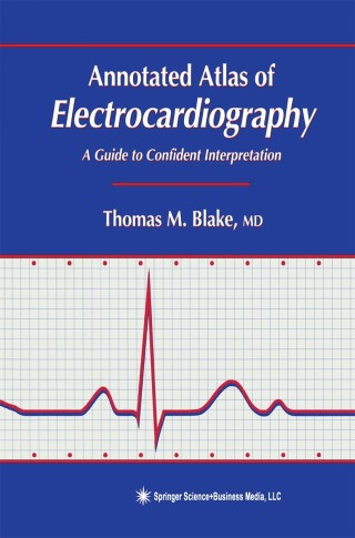 表紙画像: Annotated Atlas of Electrocardiography 9780896037625