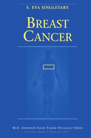 Imagen de portada: Breast Cancer 1st edition 9780387983691