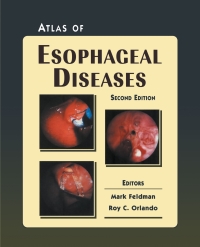 صورة الغلاف: Atlas of Esophageal Diseases 2nd edition 9781573401814