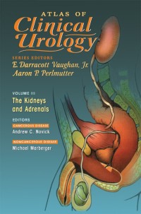 Cover image: Atlas of Clinical Urology 1st edition 9781573401227