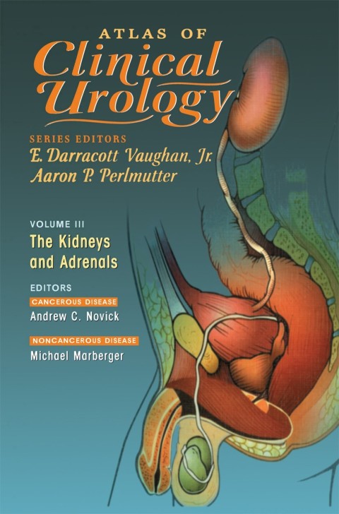 Atlas of Clinical Urology: The Kidneys and Adrenals, 1st Edition - FULL INSTANT DOWNLOAD | PDF DOCX EPUB