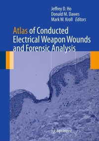 Imagen de portada: Atlas of Conducted Electrical Weapon Wounds and Forensic Analysis 1st edition 9781461435426
