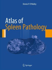 Cover image: Atlas of Spleen Pathology 9781461446712