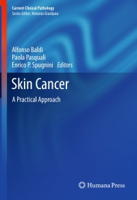 Immagine di copertina: Skin Cancer 9781461473565