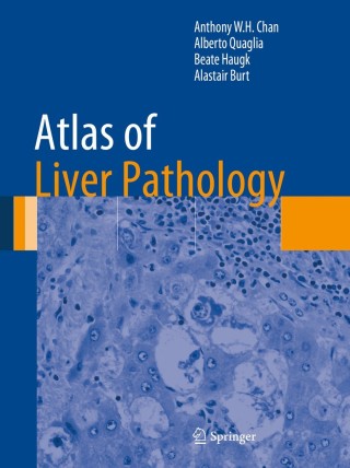 Titelbild: Atlas of Liver Pathology 9781461491132