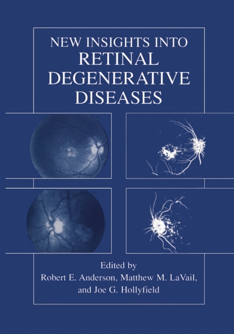 New Insights Into Retinal Degenerative Diseases, 1st Edition - FULL INSTANT DOWNLOAD | PDF DOCX EPUB