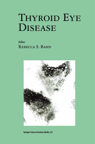 صورة الغلاف: Thyroid Eye Disease 1st edition 9780792373803