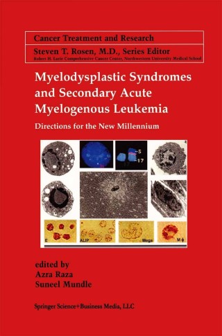 Imagen de portada: Myelodysplastic Syndromes & Secondary Acute Myelogenous Leukemia 1st edition 9780792373964