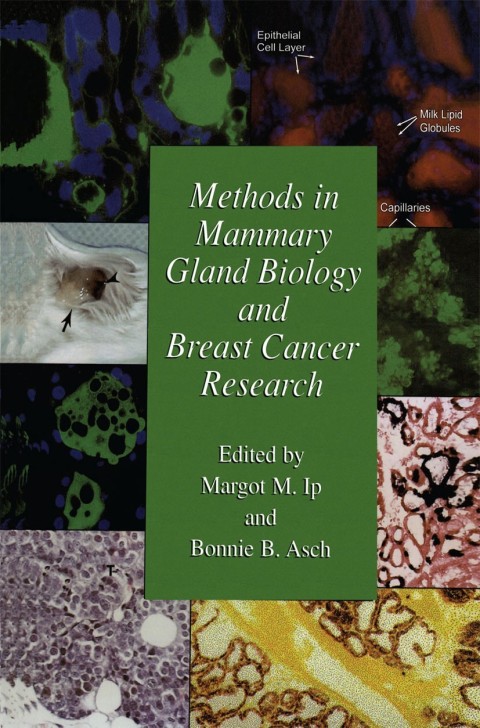 Methods in Mammary Gland Biology and Breast Cancer Research, 1st Edition - FULL INSTANT DOWNLOAD | PDF DOCX EPUB