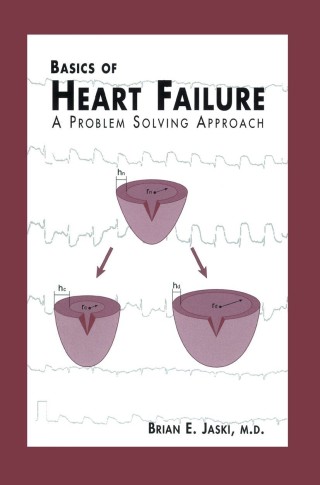 Cover image: Basics of Heart Failure 9780792377863