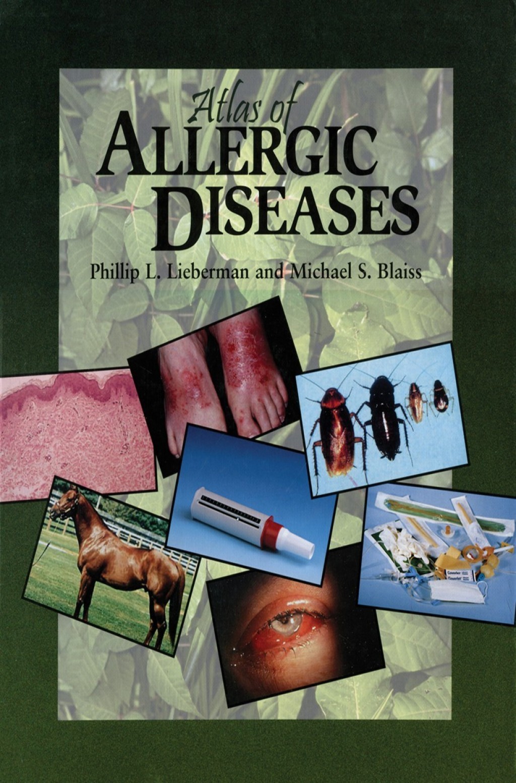 Atlas of Allergic Diseases 1st Edition