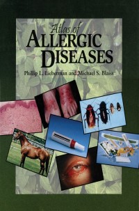 Imagen de portada: Atlas of Allergic Diseases 1st edition 9781573401821