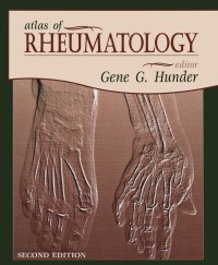 Imagen de portada: Atlas of Rheumatology 2nd edition 9781573401715